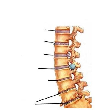 Etapas de desarrollo de la osteocondrosis.