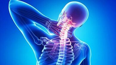 ¿Cómo se manifiesta la osteocondrosis