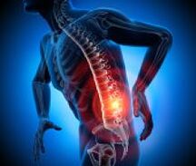diferentes causas de dolor de espalda